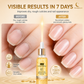 Nail Cuticle Essential Oil with Dropper