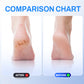 Rechargeable Electric Foot Grinder